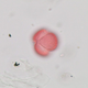 Maple tree pollen.